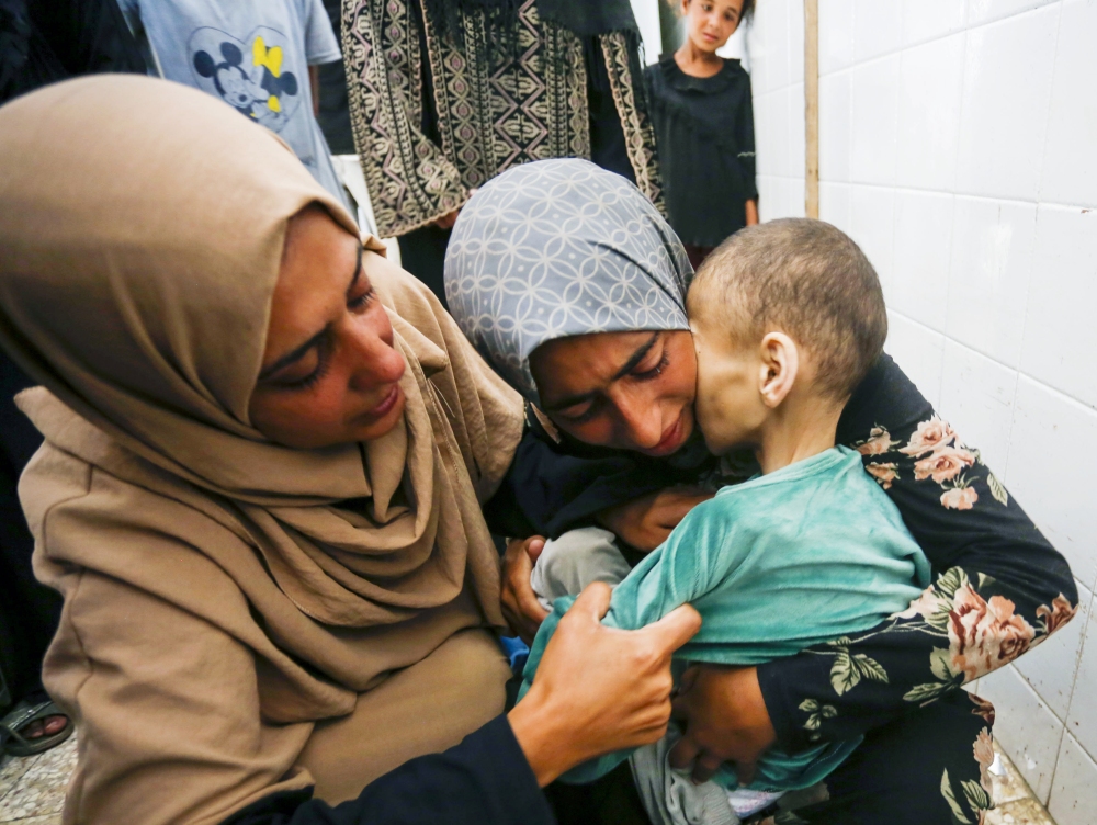 Fatma Hijazi holds the lifeless body of her 10-year-old child, Mustafa Hijazi, who died due to malnutrition and lack of medication in Deir al-Balah, Gaza. The photo is from June 14. (Anadolu via Getty Images)